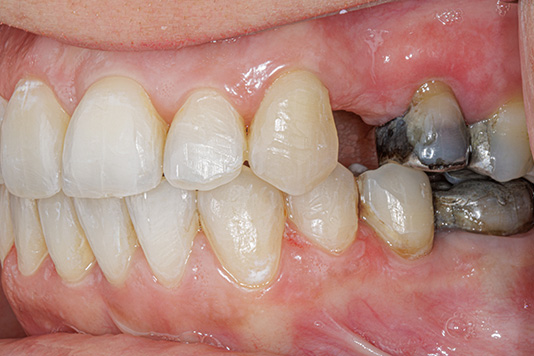 case1-a-02