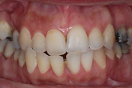 case1-b-01