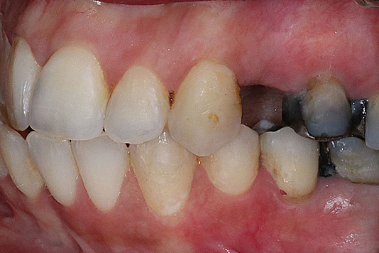 case1-b-02
