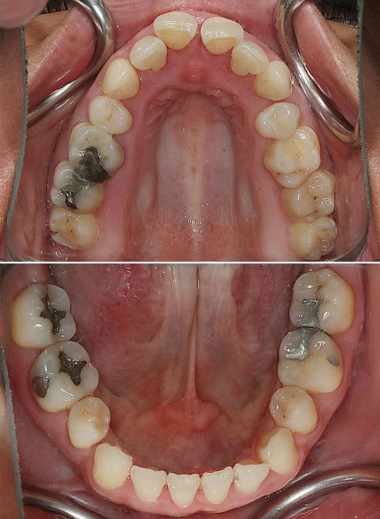 case-7-2-befor-1