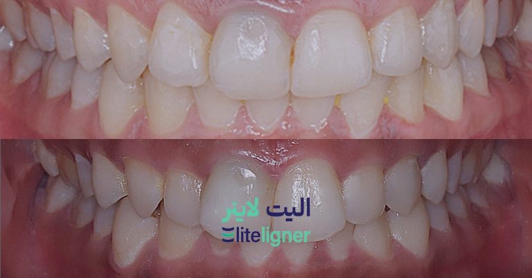 case-study-ayda-8-min